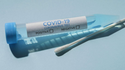 Les laboratoires d’analyse médicale tapent du poing sur la table